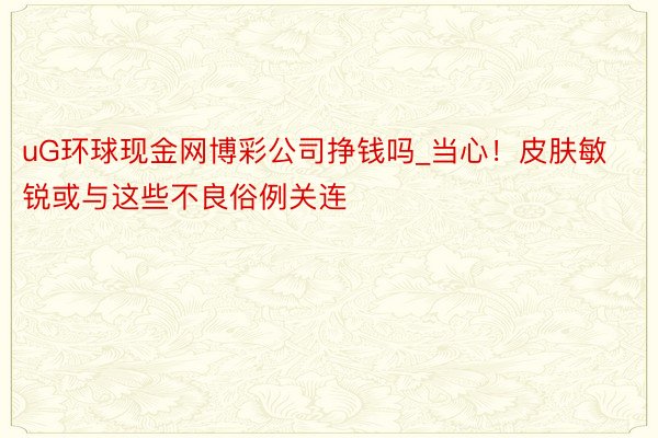 uG环球现金网博彩公司挣钱吗_当心！皮肤敏锐或与这些不良俗例关连